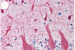Human Brain, Cerebellum (formalin-fixed, paraffin-embedded) stained with SNCG antibody ABIN364362 at 5 ug/ml followed by biotinylated goat anti-rabbit IgG secondary antibody ABIN481713, alkaline phosphatase-streptavidin and chromogen. (SNCG Antikörper)