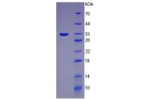 SDS-PAGE analysis of Mouse Keratin 5 Protein.