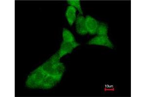 Immunofluorescence (IF) image for anti-Matrix Metallopeptidase 3 (Stromelysin 1, Progelatinase) (MMP3) (Ser373) antibody (ABIN615526)