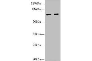 Western blot All lanes: IWS1 antibody at 3. (IWS1 Antikörper  (AA 570-819))