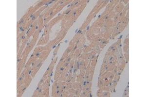 Used in DAB staining on fromalin fixed paraffin- embedded Kidney tissue (PGAM2 Antikörper  (AA 1-253))