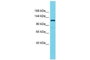 Host:  Rabbit  Target Name:  Hdac7  Sample Type:  Rat Spleen lysates  Antibody Dilution:  1. (HDAC7 Antikörper  (N-Term))