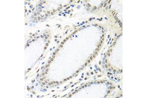Immunohistochemistry of paraffin-embedded human stomach using ELAVL1 antibody. (ELAVL1 Antikörper)