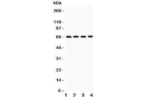 Western blot testing of Optineurin antibody and Lane 1:  HeLa;  2: U87;  3: SMMC;  4: HT1080.