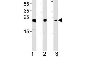 HMGB2 antibody western blot analysis in (1) HL-60, (2) K562, (3) H-4-II-E lysate. (HMGB2 Antikörper  (AA 92-118))