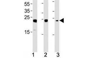 HMGB2 antibody western blot analysis in (1) HL-60, (2) K562, (3) H-4-II-E lysate. (HMGB2 Antikörper  (AA 92-118))