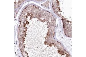 Immunohistochemical staining of human testis with IZUMO1 polyclonal antibody  shows strong cytoplasmic positivity in cells in seminiferus ducts. (IZUMO1 Antikörper)