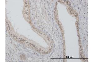 Immunoperoxidase of purified MaxPab antibody to FLOT2 on formalin-fixed paraffin-embedded human prostate. (Flotillin 2 Antikörper  (AA 1-379))