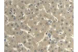 Detection of ALDH1A2 in Human Liver Tissue using Polyclonal Antibody to Aldehyde Dehydrogenase 1 Family, Member A2 (ALDH1A2)