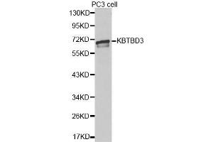 Western blot analysis of extracts of PC3 cell lines, using KBTBD3 antibody. (KBTBD3 Antikörper  (AA 410-607))