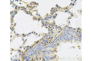 Immunohistochemistry of paraffin-embedded Rat lung using UBE2B Polyclonal Antibody at dilution of 1:100 (40x lens).