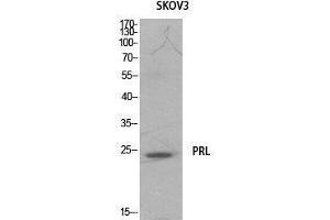 Western Blotting (WB) image for anti-Prolactin (PRL) (Internal Region) antibody (ABIN6281197)