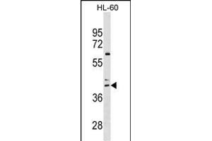 CCR4 Antibody (C-term) (ABIN1536966 and ABIN2849635) western blot analysis in HL-60 cell line lysates (35 μg/lane). (CCR4 Antikörper  (C-Term))