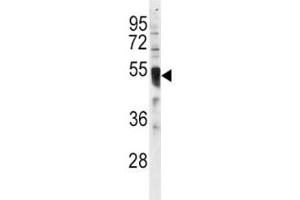 Western blot analysis of IRF8 antibody and HL-60 lysate. (IRF8 Antikörper  (AA 384-409))