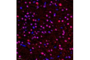 Immunofluorescence of paraffin embedded rat brain using HOXC9 (ABIN7074251) at dilution of 1:650 (400x lens) (HOXC9 Antikörper)
