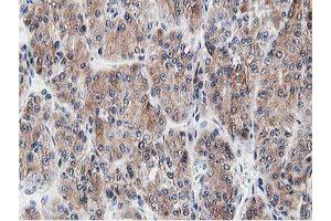 Image no. 6 for anti-Leucine Carboxyl Methyltransferase 1 (LCMT1) antibody (ABIN1499107) (LCMT1 Antikörper)