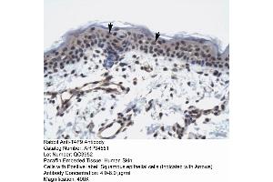 Human Skin (TAF9 Antikörper  (N-Term))
