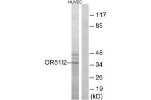 Western Blotting (WB) image for anti-Olfactory Receptor, Family 51, Subfamily I, Member 2 (OR51I2) (Internal Region) antibody (ABIN1853130) (OR51I2 Antikörper  (Internal Region))