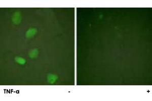 Immunofluorescence analysis of HeLa cells, treated with TNF-a (20 nM, 15 mins), using HDAC3 polyclonal antibody . (HDAC3 Antikörper)