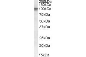 Western Blotting (WB) image for anti-Taste Receptor, Type 1, Member 2 (TAS1R2) (Internal Region) antibody (ABIN238627)