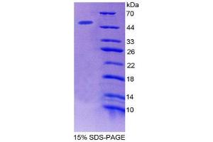 SDS-PAGE (SDS) image for Microfibrillar Associated Protein 2 (MFAP2) (AA 8-171) protein (His tag,GST tag) (ABIN2123275)