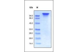 Human ErbB3, Fc Tag on SDS-PAGE under reducing (R) condition. (ERBB3 Protein (AA 20-643) (Fc Tag))