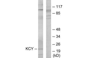 Western Blotting (WB) image for anti-KCY (N-Term) antibody (ABIN1849302) (KCY (N-Term) Antikörper)