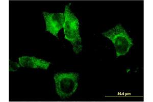 Immunofluorescence of monoclonal antibody to CEL on HeLa cell. (Cholesterol Esterase Antikörper  (AA 378-477))