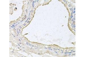 Immunohistochemistry of paraffin-embedded Human prostate using HPR Polyclonal Antibody at dilution of 1:100 (40x lens). (HPR Antikörper)