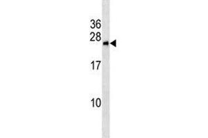 BNIP1 antibody western blot analysis in MCF-7 lysate (BNIP1 Antikörper  (AA 26-55))