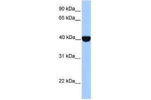 CK2 alpha antibody used at 1 ug/ml to detect target protein. (CSNK2A1/CK II alpha Antikörper  (C-Term))
