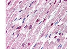 Anti-TUBA1 / Tubulin Alpha 1 antibody IHC of human heart.