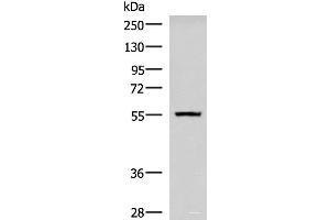 Western blot analysis of Human cerebella tissue lysate using CAMKK1 Polyclonal Antibody at dilution of 1:700 (CAMKK1 Antikörper)