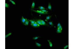 Immunofluorescence staining of Hela cells with ABIN7173439 at 1:133, counter-stained with DAPI. (TRIM35 Antikörper  (AA 1-206))