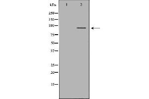 Western blot analysis of 293T whole cell lysates, using OCA2 Antibody. (OCA2 Antikörper  (N-Term))