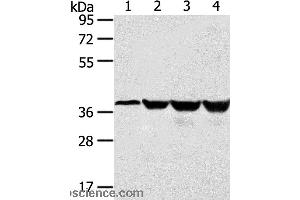 Western blot analysis of Human normal liver tissue and hepg2 cell, Jurkat and K562 cell, using HMOX2 Polyclonal Antibody at dilution of 1:550 (HMOX2 Antikörper)