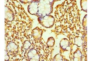 Immunohistochemistry of paraffin-embedded human small intestine tissue using ABIN7167346 at dilution of 1:100 (Rab4 Antikörper  (AA 1-218))