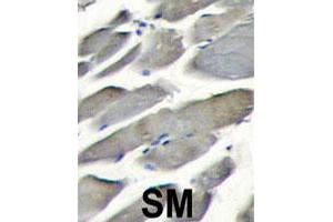 Formalin-fixed and paraffin-embedded human skeletal muscle tissue reacted with PIK3CG polyclonal antibody  , which was peroxidase-conjugated to the secondary antibody, followed by DAB staining. (PIK3 gamma Antikörper  (Internal Region))