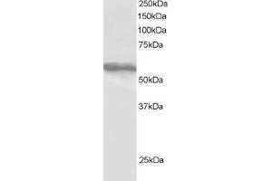 Western Blotting (WB) image for anti-Tripartite Motif-containing 4 (TRIM4) (C-Term) antibody (ABIN2466398) (TRIM4 Antikörper  (C-Term))