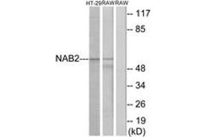 Western blot analysis of extracts from HT-29/RAW264. (NAB2 Antikörper  (AA 261-310))