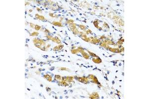 Immunohistochemistry of paraffin-embedded human stomach using OGN antibody (ABIN6131952, ABIN6145008, ABIN6145009 and ABIN6222384) at dilution of 1:100 (40x lens). (OGN Antikörper  (AA 20-298))