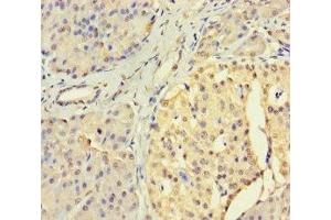 Immunohistochemistry of paraffin-embedded human pancreatic tissue using ABIN7174304 at dilution of 1:100 (USP3 Antikörper  (C-Term))
