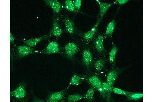 Immunofluorescence (IF) image for anti-Tumor Protein P53 (TP53) (C-Term) antibody (ABIN870298) (p53 Antikörper  (C-Term))