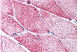 Human Skeletal Muscle (formalin-fixed, paraffin-embedded) stained with ACTA2 antibody ABIN213651 at 5 ug/ml followed by biotinylated goat anti-rabbit IgG secondary antibody ABIN481713, alkaline phosphatase-streptavidin and chromogen. (Smooth Muscle Actin Antikörper  (N-Term))