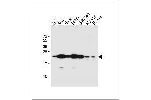 All lanes : Anti-RAB1B Antibody (C-term) at 1:1000 dilution Lane 1: 293 whole cell lysate Lane 2: A431 whole cell lysate Lane 3: Hela whole cell lysate Lane 4: T47D whole cell lysate Lane 5: U-87MG whole cell lysate Lane 6: Mouse liver lysate Lane 7: Rat liver lysate Lysates/proteins at 20 μg per lane. (RAB1B Antikörper  (C-Term))
