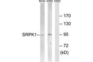 Western Blotting (WB) image for anti-SRSF Protein Kinase 1 (SRPK1) (AA 521-570) antibody (ABIN2890620) (SRPK1 Antikörper  (AA 521-570))