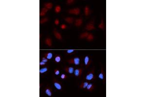 Immunofluorescence (IF) image for anti-SH2B Adaptor Protein 1 (SH2B1) antibody (ABIN1876744) (SH2B1 Antikörper)