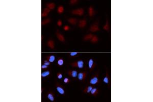 Immunofluorescence (IF) image for anti-SH2B Adaptor Protein 1 (SH2B1) antibody (ABIN1876744)