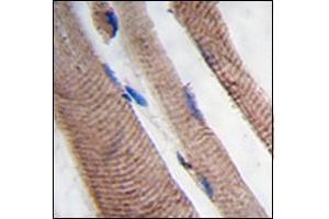 Formalin-fixed and paraffin-embedded human skeletal muscle tissue reacted with PI3KC3 Antibody , which was peroxidase-conjugated to the secondary antibody, followed by DAB staining. (PIK3C3 Antikörper  (AA 19-49))