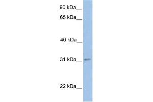 WB Suggested Anti-ECHDC2 Antibody Titration:  0. (ECHDC2 Antikörper  (Middle Region))